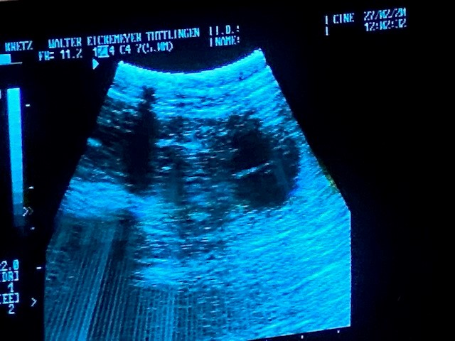 frieda ultraschall